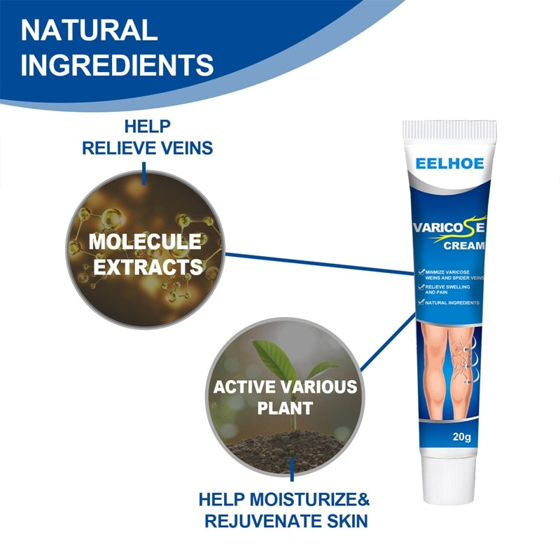 Varicose Veins Treatment Ointment Cream Relief Veins Pain